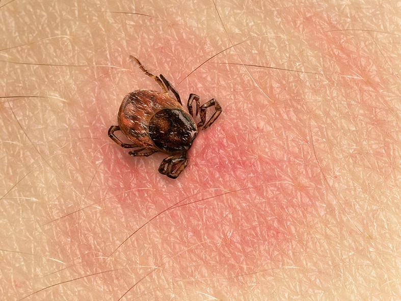 Bolerioza badania