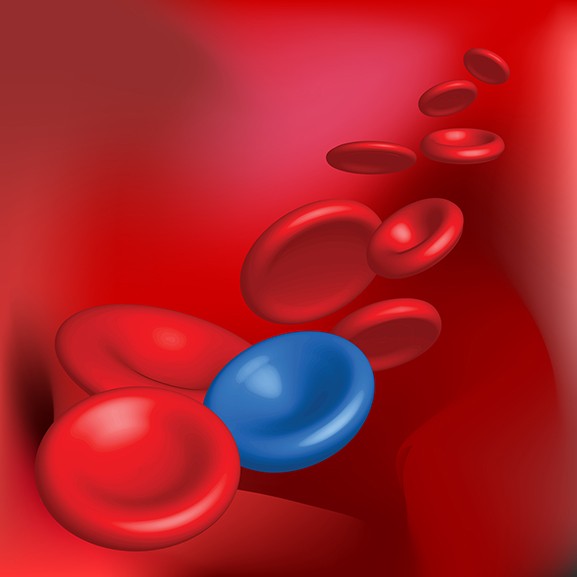 Anemia