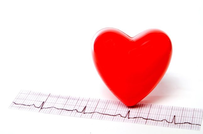 EKG