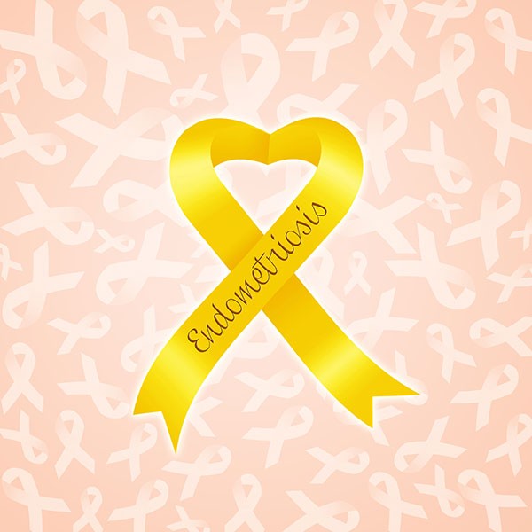 Endometrioza