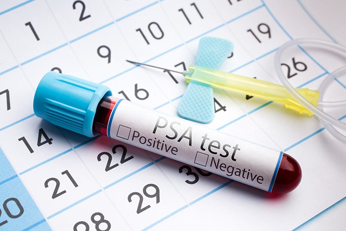 PSA test