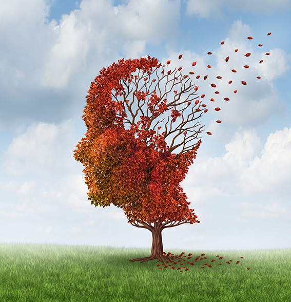 Choroba Alzheimera