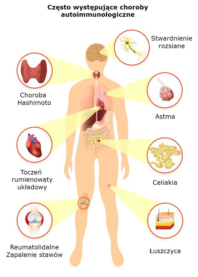 Choroby autoimmunologiczne