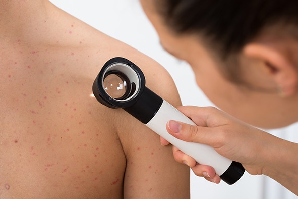 Dermatologia trądzik