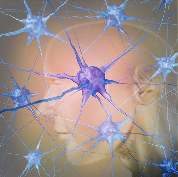 Alzheimer