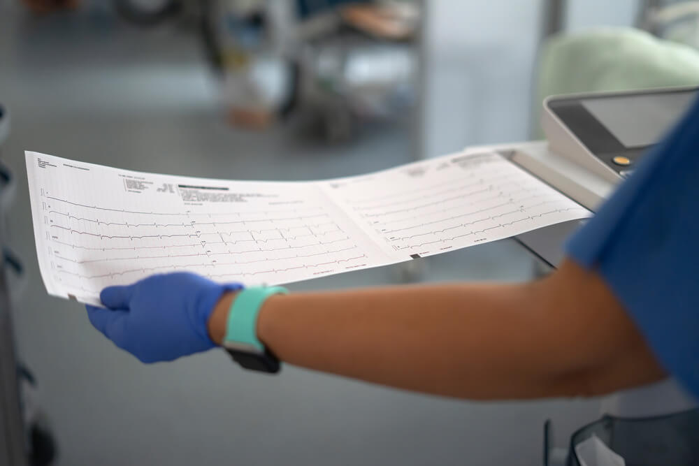 Echo serca, EKG czy holter – czym różnią się badania kardiologiczne